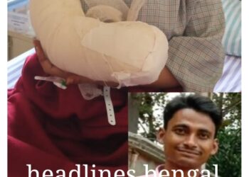 স্ত্রী’র সরকারী চাকরী পছন্দ নয়,ঘুমন্ত অবস্থায় স্ত্রী’র হাতের কব্জি কেটে নিলো স্বামী।